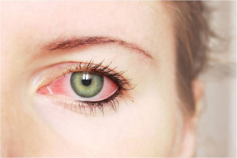 glaucoma-uma-doenca-visual-que-precisa-de-atencao